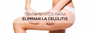 tratamientos para eliminar la celulitis