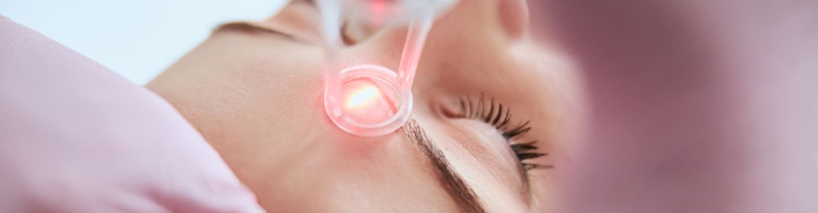 aplicación laser